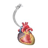 کانولای آئورتAORTIC ARCH CANNULAE